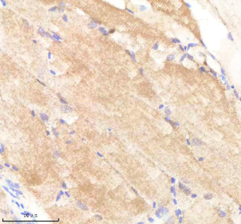 Zebrafish Pafah1b1 Antibody Muscle Tissue IHC. Immunohistochemistry staining of FFPE zebrafish muscle tissue with Pafah1b1 antibody, HRP-labeled secondary and DAB substrate. HIER: boil tissue sections in pH8 EDTA for 20 min and allow to cool before testing.