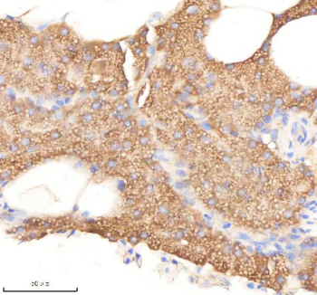 Zebrafish Pafah1b1 Antibody Pancreas Tissue IHC. Immunohistochemistry staining of FFPE zebrafish pancreas tissue with Pafah1b1 antibody, HRP-labeled secondary and DAB substrate. HIER: boil tissue sections in pH8 EDTA for 20 min and allow to cool before testing.