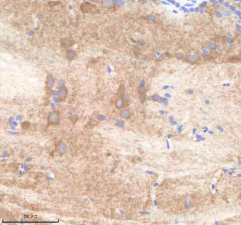 Zebrafish Pard3aa Antibody Brain Tissue IHC. Immunohistochemistry staining of zebrafish Pard3aa protein using Zebrafish Pard3aa antibody, HRP-labeled secondary and DAB substrate. Pard3aa was detected in a paraffin-embedded section of zebrafish brain tissue. HIER: boil tissue sections in pH8 EDTA for 20 min and allow to cool before testing.