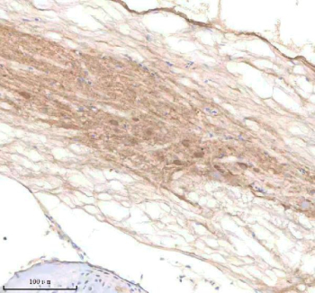 Zebrafish Pard3aa Antibody Spinal Tissue IHC. Immunohistochemistry staining of zebrafish Pard3aa protein using Zebrafish Pard3aa antibody, HRP-labeled secondary and DAB substrate. Pard3aa was detected in a paraffin-embedded section of zebrafish spinal tissue. HIER: boil tissue sections in pH8 EDTA for 20 min and allow to cool before testing.