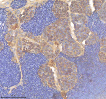 Zebrafish Pard3aa Antibody Testis Tissue IHC. Immunohistochemistry staining of zebrafish Pard3aa protein using Zebrafish Pard3aa antibody, HRP-labeled secondary and DAB substrate. Pard3aa was detected in a paraffin-embedded section of zebrafish testis tissue. HIER: boil tissue sections in pH8 EDTA for 20 min and allow to cool before testing.