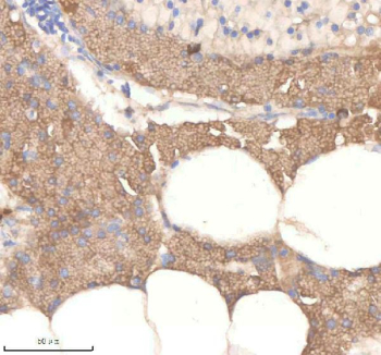 Zebrafish Pard3aa Antibody Pancreas Tissue IHC. Immunohistochemistry staining of zebrafish Pard3aa protein using Zebrafish Pard3aa antibody, HRP-labeled secondary and DAB substrate. Pard3aa was detected in a paraffin-embedded section of zebrafish pancreas tissue. HIER: boil tissue sections in pH8 EDTA for 20 min and allow to cool before testing.