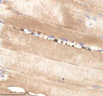 Zebrafish Pard3aa Antibody Muscle Tissue IHC. Immunohistochemistry staining of zebrafish Pard3aa protein using Zebrafish Pard3aa antibody, HRP-labeled secondary and DAB substrate. Pard3aa was detected in a paraffin-embedded section of zebrafish muscle tissue. HIER: boil tissue sections in pH8 EDTA for 20 min and allow to cool before testing.