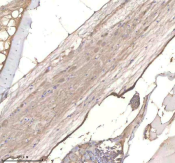 Zebrafish Phyhipl Antibody Spinal Tissue IHC. Immunohistochemistry staining of zebrafish Phyhipl/b protein using Zebrafish Phyhipl antibody, HRP-labeled secondary and DAB substrate. Phyhipl was detected in a paraffin-embedded section of zebrafish spinal tissue. HIER: boil tissue sections in pH8 EDTA for 20 min and allow to cool before testing.
