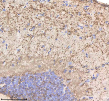 Zebrafish Phyhipl Antibody Brain Tissue IHC. Immunohistochemistry staining of zebrafish Phyhipl/b protein using Zebrafish Phyhipl antibody, HRP-labeled secondary and DAB substrate. Phyhipl was detected in a paraffin-embedded section of zebrafish brain tissue. HIER: boil tissue sections in pH8 EDTA for 20 min and allow to cool before testing.
