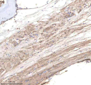 Zebrafish Pi4kb Antibody Spinal Tissue IHC. Immunohistochemistry staining of zebrafish PI4KB protein using Zebrafish PI4KB antibody, HRP-labeled secondary and DAB substrate. PI4KB was detected in a paraffin-embedded section of zebrafish spinal tissue. HIER: boil tissue sections in pH8 EDTA for 20 min and allow to cool before testing.