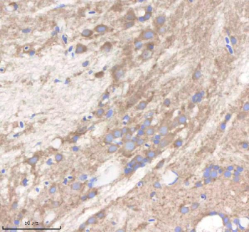 Zebrafish Pi4kb Antibody Brain Tissue IHC. Immunohistochemistry staining of zebrafish Pi4kb protein using Zebrafish Pi4kb antibody, HRP-labeled secondary and DAB substrate. Pi4kb was detected in a paraffin-embedded section of zebrafish brain tissue. HIER: boil tissue sections in pH8 EDTA for 20 min and allow to cool before testing.