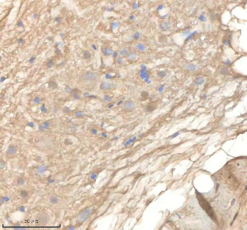 Zebrafish Ppm1g Antibody Brain Tissue IHC. Immunohistochemistry staining of zebrafish Ppm1g protein using Zebrafish Ppm1g antibody, HRP-labeled secondary and DAB substrate. Ppm1g was detected in a paraffin-embedded section of zebrafish brain tissue. HIER: boil tissue sections in pH8 EDTA for 20 min and allow to cool before testing.