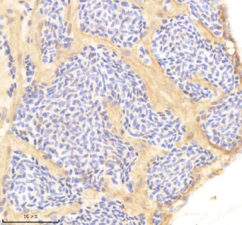 Zebrafish Ppp3r1 Antibody Heart Tissue IHC. Immunohistochemistry staining of FFPE zebrafish heart tissue with Ppp3r1 antibody, HRP-labeled secondary and DAB substrate. HIER: boil tissue sections in pH8 EDTA for 20 min and allow to cool before testing.