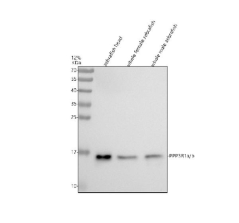 Zebrafish Ppp3r1 Antibody Tissue WB. Western blot analysis of Ppp3r1a/b protein using Zebrafish Ppp3r1 antibody and 1) zebrafish head, 2) whole female zebrafish, 3) whole male zebrafish tissue lysate. Predicted molecular weight ~19 kDa.