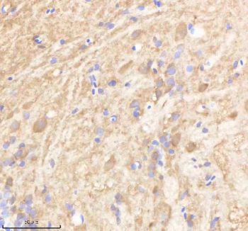 Zebrafish Ppp3r1 Antibody Brain Tissue IHC. Immunohistochemistry staining of FFPE zebrafish brain tissue with Ppp3r1 antibody, HRP-labeled secondary and DAB substrate. HIER: boil tissue sections in pH8 EDTA for 20 min and allow to cool before testing.