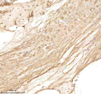 Zebrafish Ppp3r1 Antibody Spinal Tissue IHC. Immunohistochemistry staining of FFPE zebrafish spinal tissue with Ppp3r1 antibody, HRP-labeled secondary and DAB substrate. HIER: boil tissue sections in pH8 EDTA for 20 min and allow to cool before testing.