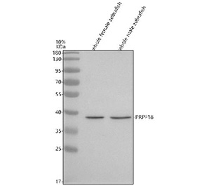 Zebrafish Prpf18 Antibody Tissue WB. Western blot analysis of Prpf18 protein using Zebrafish Prpf18 antibody and 1) whole female zebrafish tissue lysates and 2) whole male zebrafish tissue lysates. Predicted molecular weight ~39 kDa.