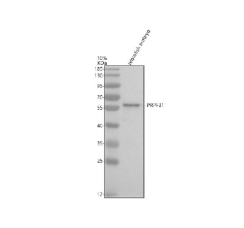 Zebrafish Prpf31 Antibody Embryo Tissue WB. Western blot analysis of Prpf31 protein using Zebrafish Prpf31 antibody and zebrafish embryo tissue lysates. Predicted molecular weight ~56 kDa.