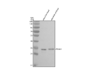 Zebrafish Psma1 Antibody Head and Embryo Tissue WB. Western blot analysis of Psma1 protein using Zebrafish PSMA1 antibody and 1) zebrafish head tissue lysates and 2) zebrafish embryo tissue lysate. Predicted molecular weight ~29 kDa.