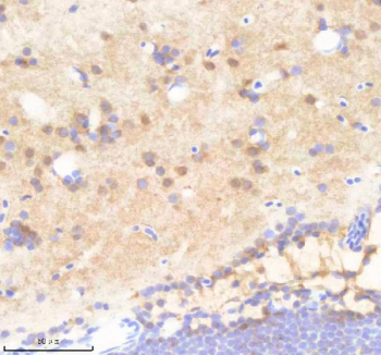 Zebrafish Psma1 Antibody Brain Tissue IHC. Immunohistochemistry staining of FFPE zebrafish brain tissue with Psma1 antibody, HRP-labeled secondary and DAB substrate. HIER: boil tissue sections in pH8 EDTA for 20 min and allow to cool before testing.