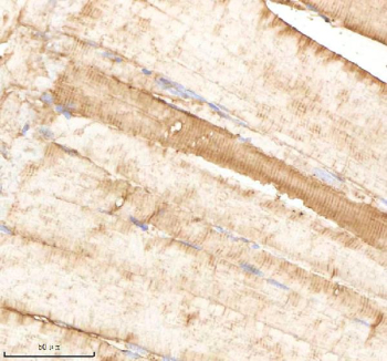 Zebrafish Psmb1 Antibody Muscle Tissue IHC. Immunohistochemistry staining of FFPE zebrafish muscle tissue with Psmb1 antibody, HRP-labeled secondary and DAB substrate. HIER: boil tissue sections in pH8 EDTA for 20 min and allow to cool before testing.