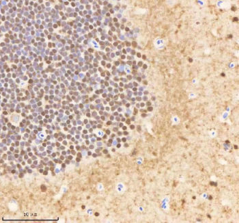 Zebrafish Psmc1 Antibody Brain Tissue IHC. Immunohistochemistry staining of FFPE zebrafish brain tissue with Psmc1 antibody, HRP-labeled secondary and DAB substrate. HIER: boil tissue sections in pH8 EDTA for 20 min and allow to cool before testing.