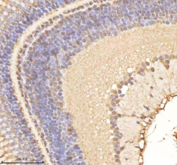 Zebrafish Psmc1 Antibody Eye Tissue IHC. Immunohistochemistry staining of FFPE zebrafish eye tissue with Psmc1 antibody, HRP-labeled secondary and DAB substrate. HIER: boil tissue sections in pH8 EDTA for 20 min and allow to cool before testing.