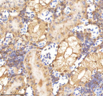 Zebrafish Psmc1 Antibody Kidney Tissue IHC. Immunohistochemistry staining of FFPE zebrafish kidney tissue with Psmc1 antibody, HRP-labeled secondary and DAB substrate. HIER: boil tissue sections in pH8 EDTA for 20 min and allow to cool before testing.