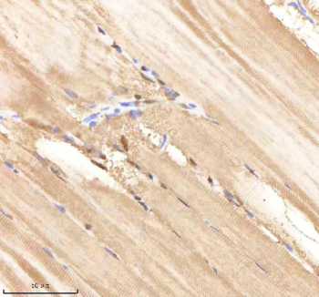 Zebrafish Psmc1 Antibody Muscle Tissue IHC. Immunohistochemistry staining of FFPE zebrafish muscle tissue with Psmc1 antibody, HRP-labeled secondary and DAB substrate. HIER: boil tissue sections in pH8 EDTA for 20 min and allow to cool before testing.