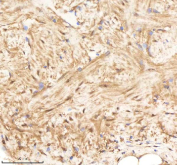 Zebrafish Psmc1 Antibody Heart Tissue IHC. Immunohistochemistry staining of FFPE zebrafish heart tissue with Psmc1 antibody, HRP-labeled secondary and DAB substrate. HIER: boil tissue sections in pH8 EDTA for 20 min and allow to cool before testing.