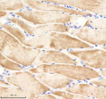 Zebrafish Psmc2 Antibody Muscle Tissue IHC. Immunohistochemistry staining of FFPE zebrafish muscle tissue with Psmc2 antibody, HRP-labeled secondary and DAB substrate. HIER: boil tissue sections in pH8 EDTA for 20 min and allow to cool before testing.