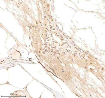 Zebrafish Psmc5 Antibody Spinal Tissue IHC. Immunohistochemistry staining of zebrafish Psmc5 protein using Zebrafish Psmc5 antibody, HRP-labeled secondary and DAB substrate. Psmc5 was detected in a paraffin-embedded section of zebrafish spinal tissue. HIER: boil tissue sections in pH8 EDTA for 20 min and allow to cool before testing.