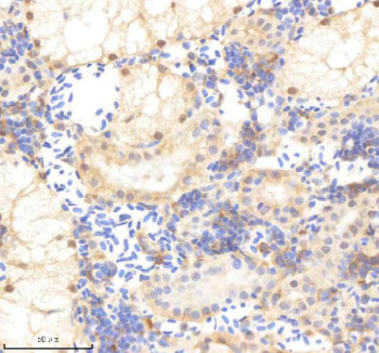 Zebrafish Psmc5 Antibody Kidney Tissue IHC. Immunohistochemistry staining of zebrafish Psmc5 protein using Zebrafish Psmc5 antibody, HRP-labeled secondary and DAB substrate. Psmc5 was detected in a paraffin-embedded section of zebrafish kidney tissue. HIER: boil tissue sections in pH8 EDTA for 20 min and allow to cool before testing.