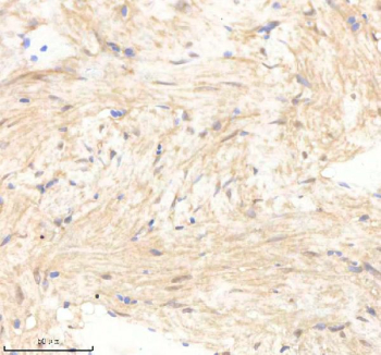 Zebrafish Psmc5 Antibody Heart Tissue IHC. Immunohistochemistry staining of zebrafish PSMC5 protein using Zebrafish PSMC5 antibody, HRP-labeled secondary and DAB substrate. PSMC5 was detected in a paraffin-embedded section of zebrafish heart tissue. HIER: boil tissue sections in pH8 EDTA for 20 min and allow to cool before testing.