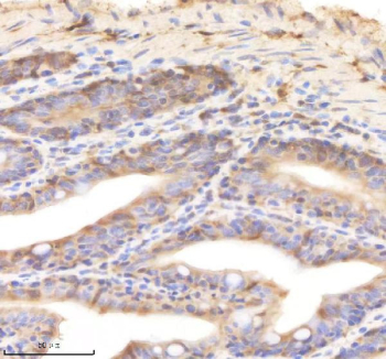 Zebrafish Psmd8 Antibody Colon Tissue IHC. Immunohistochemistry staining of zebrafish Psmd8 protein using Zebrafish Psmd8 antibody, HRP-labeled secondary and DAB substrate. Psmd8 was detected in a paraffin-embedded section of zebrafish colon tissue. HIER: boil tissue sections in pH8 EDTA for 20 min and allow to cool before testing.