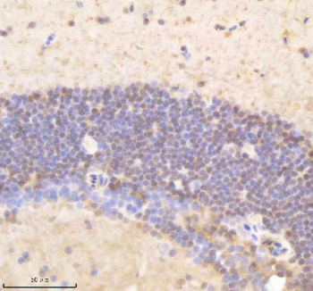 Zebrafish Psmd8 Antibody Brain Tissue IHC. Immunohistochemistry staining of zebrafish Psmd8 protein using Zebrafish Psmd8 antibody, HRP-labeled secondary and DAB substrate. Psmd8 was detected in a paraffin-embedded section of zebrafish brain tissue. HIER: boil tissue sections in pH8 EDTA for 20 min and allow to cool before testing.