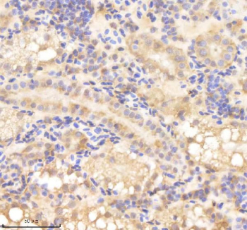 Zebrafish Psmd8 Antibody Kidney Tissue IHC. Immunohistochemistry staining of zebrafish Psmd8 protein using Zebrafish Psmd8 antibody, HRP-labeled secondary and DAB substrate. Psmd8 was detected in a paraffin-embedded section of zebrafish kidney tissue. HIER: boil tissue sections in pH8 EDTA for 20 min and allow to cool before testing.