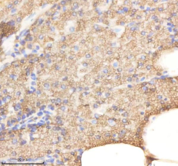 Zebrafish Rab14 Antibody Pancreas Tissue IHC. Immunohistochemistry staining of FFPE zebrafish pancreas tissue with Rab14 antibody, HRP-labeled secondary and DAB substrate. HIER: boil tissue sections in pH8 EDTA for 20 min and allow to cool before testing.