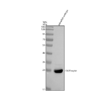 Zebrafish Rab1a Antibody Embryo Tissue WB. Western blot analysis of Rab1aa/ab protein using Zebrafish Rab1a antibody and zebrafish embryo tissue lysates.  Predicted molecular weight ~23 kDa.