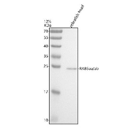 Zebrafish Rab5a Antibody Head Tissue WB. Western blot analysis of Rab5aa/ab protein using Zebrafish RAB5aa/ab antibody and zebrafish head tissue lysates. Predicted molecular weight ~23 kDa.