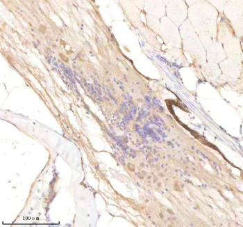 Zebrafish Rcc2 Antibody Spinal Tissue IHC. Immunohistochemistry staining of FFPE zebrafish spinal cord tissue with Rcc2 antibody, HRP-labeled secondary and DAB substrate. HIER: boil tissue sections in pH8 EDTA for 20 min and allow to cool before testing.