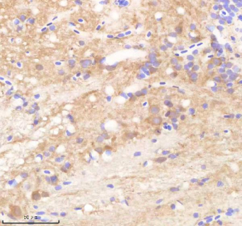 Zebrafish Rcc2 Antibody Brain Tissue IHC. Immunohistochemistry staining of FFPE zebrafish brain tissue with Rcc2 antibody, HRP-labeled secondary and DAB substrate. HIER: boil tissue sections in pH8 EDTA for 20 min and allow to cool before testing.