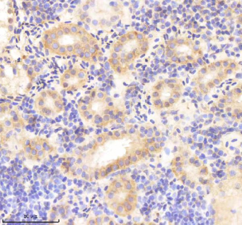 Zebrafish Rcc2 Antibody Kidney Tissue IHC. Immunohistochemistry IHC staining of FFPE zebrafish kidney tissue with Rcc2 antibody, HRP-labeled secondary and DAB substrate. HIER: boil tissue sections in pH8 EDTA for 20 min and allow to cool before testing.