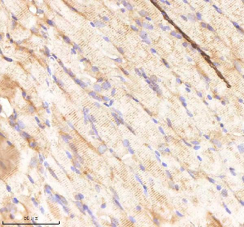 Zebrafish Rcc2 Antibody Muscle Tissue IHC. Immunohistochemistry staining of FFPE zebrafish muscle tissue with Rcc2 antibody, HRP-labeled secondary and DAB substrate. HIER: boil tissue sections in pH8 EDTA for 20 min and allow to cool before testing.