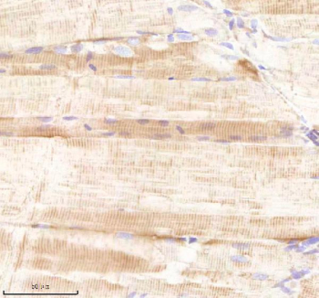 Zebrafish Sars1 Antibody Muscle Tissue IHC. Immunohistochemistry staining of FFPE zebrafish muscle tissue with Sars1 antibody, HRP-labeled secondary and DAB substrate. HIER: boil tissue sections in pH8 EDTA for 20 min and allow to cool before testing.