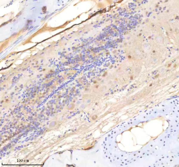 Zebrafish Sf3a1 Antibody Spinal Cord Tissue IHC. Immunohistochemistry staining of zebrafish Sf3a1 protein using Zebrafish Sf3a1 antibody, HRP-labeled secondary and DAB substrate. Sf3a1 was detected in a paraffin-embedded section of zebrafish spinal cord tissue. HIER: boil tissue sections in pH8 EDTA for 20 min and allow to cool before testing.