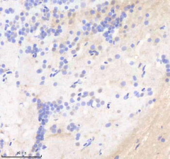 Zebrafish Sf3a1 Antibody Brain Tissue IHC. Immunohistochemistry staining of zebrafish Sf3a1 protein using Zebrafish Sf3a1 antibody, HRP-labeled secondary and DAB substrate. Sf3a1 was detected in a paraffin-embedded section of zebrafish brain tissue. HIER: boil tissue sections in pH8 EDTA for 20 min and allow to cool before testing.