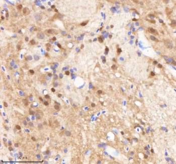 Zebrafish Sf3b3 Antibody Brain Tissue IHC. Immunohistochemistry staining of zebrafish Sf3b3 protein using Zebrafish Sf3b3 antibody, HRP-labeled secondary and DAB substrate. Sf3b3 was detected in a paraffin-embedded section of zebrafish brain tissue. HIER: boil tissue sections in pH8 EDTA for 20 min and allow to cool before testing.