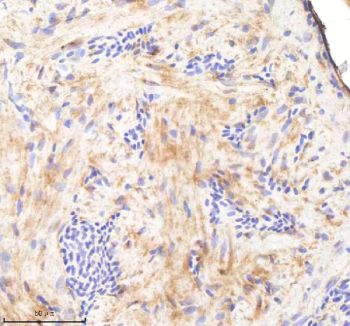 Zebrafish Sf3b3 Antibody Heart Tissue IHC. Immunohistochemistry staining of zebrafish Sf3b3 protein using Zebrafish Sf3b3 antibody, HRP-labeled secondary and DAB substrate. Sf3b3 was detected in a paraffin-embedded section of zebrafish heart tissue. HIER: boil tissue sections in pH8 EDTA for 20 min and allow to cool before testing.