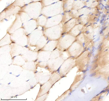 Zebrafish Sf3b3 Antibody Muscle Tissue IHC. Immunohistochemistry staining of zebrafish Sf3b3 protein using Zebrafish Sf3b3 antibody, HRP-labeled secondary and DAB substrate. Sf3b3 was detected in a paraffin-embedded section of zebrafish muscle tissue. HIER: boil tissue sections in pH8 EDTA for 20 min and allow to cool before testing.