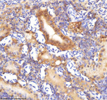 Zebrafish Sf3b3 Antibody Kidney Tissue IHC. Immunohistochemistry staining of zebrafish Sf3b3 protein using Zebrafish Sf3b3 antibody, HRP-labeled secondary and DAB substrate. Sf3b3 was detected in a paraffin-embedded section of zebrafish kidney tissue. HIER: boil tissue sections in pH8 EDTA for 20 min and allow to cool before testing.