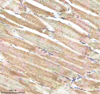 Zebrafish Shha antibody muscle tissue IHC. Immunohistochemistry staining of Sonic Hedgehog protein in FFPE zebrafish muscle tissue with Shha antibody, HRP-labeled secondary and DAB substrate. HIER: boil tissue sections in pH8 EDTA for 20 min and allow to cool before testing.
