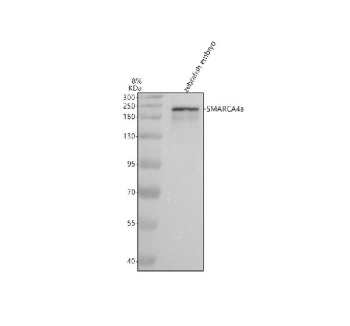 Zebrafish Smarca4a Antibody Embryo Tissue WB. Western blot analysis of Smarca4 protein using Zebrafish Smarca4a antibody and zebrafish embryo tissue lysates. Predicted molecular weight ~185 kDa, commonly observed at 185-220 kDa. (human similarity)