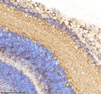 Zebrafish Smarca4a Antibody Eye Tissue IHC. Immunohistochemistry staining of zebrafish Smarca4 protein using Zebrafish Smarca4a antibody, HRP-labeled secondary and DAB substrate. Smarca4a was detected in a paraffin-embedded section of zebrafish eye tissue. HIER: boil tissue sections in pH8 EDTA for 20 min and allow to cool before testing.